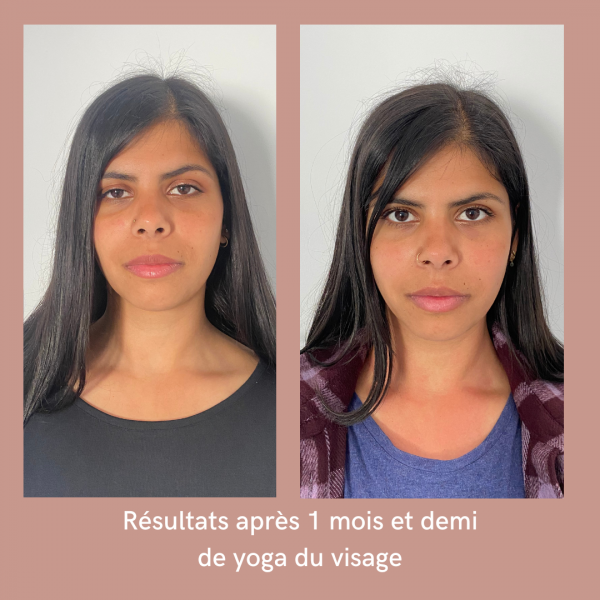 avant après yoga du visage